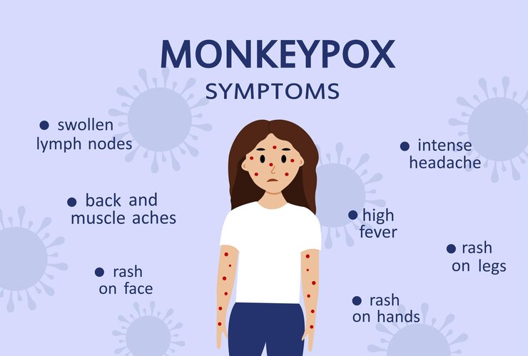 मंकीपॉक्स (Mpox) ची संपूर्ण माहिती: लक्षणे, प्रसार, आणि प्रतिबंध 2 Mpox (formerly known as monkeypox)